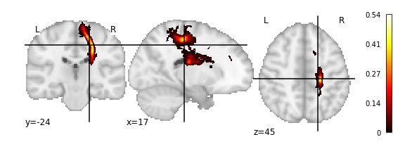 _images/02_Exploring_ConWhAt_Atlases_17_1.png