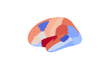 _images/02_Exploring_ConWhAt_Atlases_32_0.png