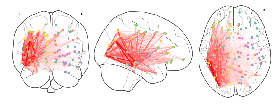 _images/04_Assess_network_impact_of_lesion_32_1.png